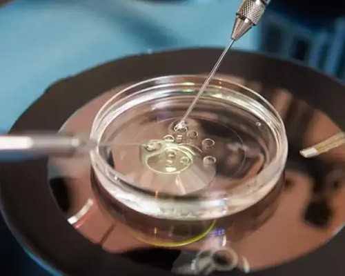 怎样备孕二胎_备孕吃什么促排卵,如何预防胎停育？备孕是关键