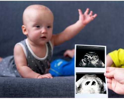 太原代生儿子价格,试管婴儿生男生女可以选择吗试管婴儿可以选男女性别吗_柳