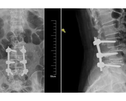 武汉试管代生,在广州中山三院做试管费用多少钱？价格介绍！_上海供卵试管公